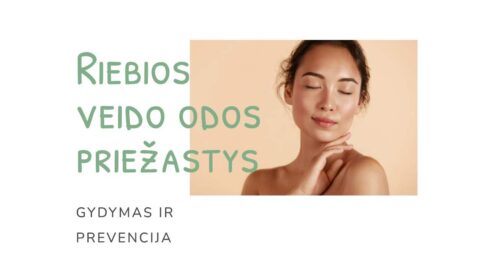 Riebios veido odos priežastys Gydymas ir prevencija