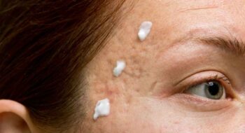 Riebios odos priežiūra. Ką daryti su veido odos blizgesiu?
