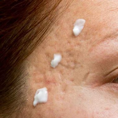 Riebios odos priežiūra. Ką daryti su veido odos blizgesiu?